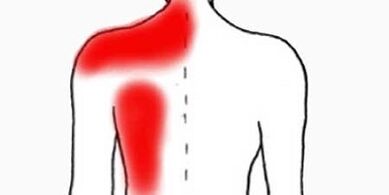 skausmas po kairiuoju pečių ašmeniu iš nugaros