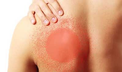 skausmas po kairiuoju pečių ašmeniu