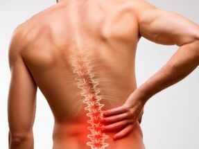 apatinės nugaros dalies skausmas dėl osteochondrozės
